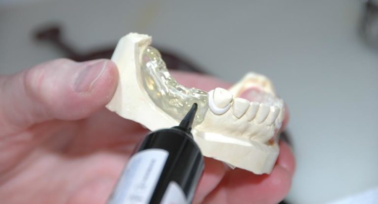 Sparen beim Zahnersatz – die Härtefallregelung